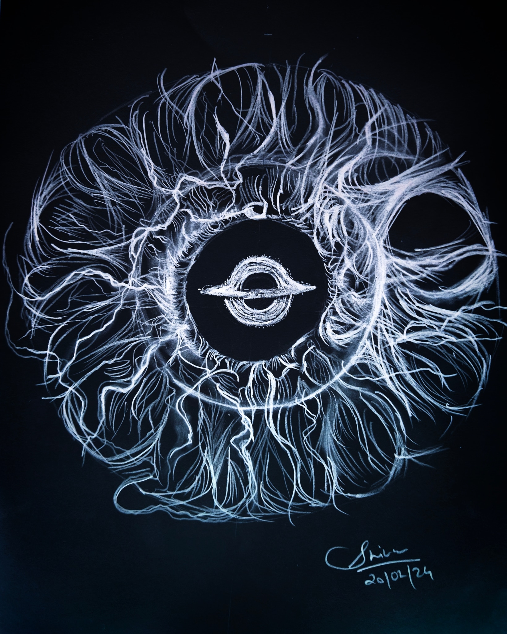 Eye